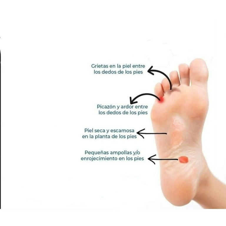 MEXSANA POLVO MEDICINAL / MEXSANA FOOT CARE AND TREATMENT