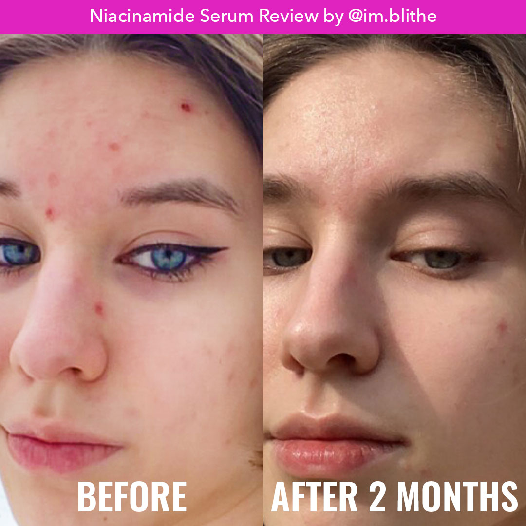 NIACINAMIDE SERUM GOOD MOLECULES